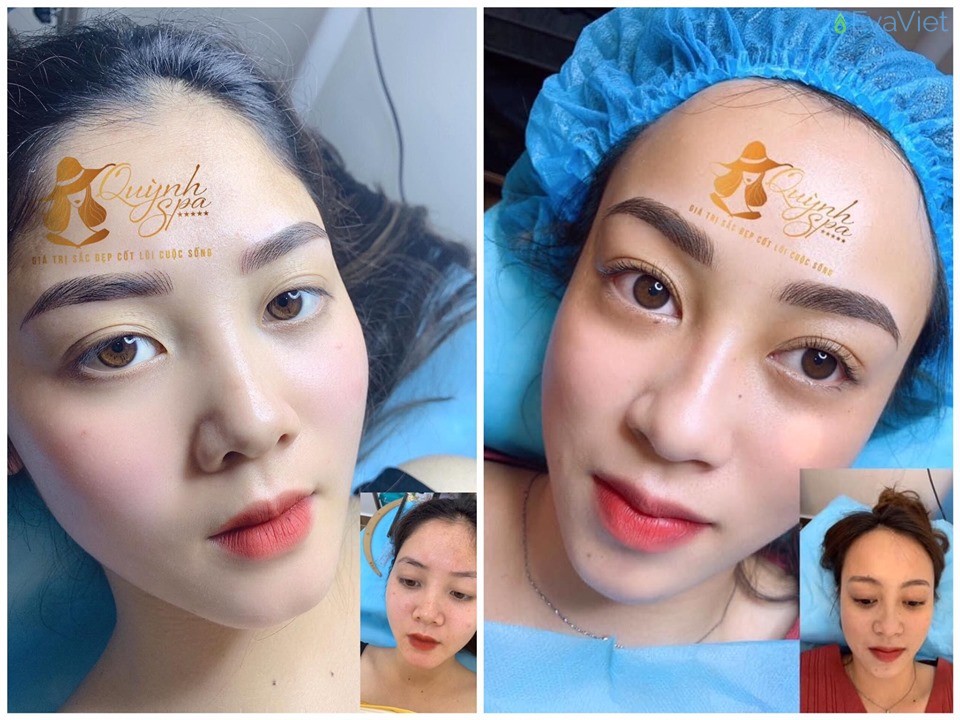 Đến với Quỳnh Spa Đà Lạt bạn sẽ được lột xác trở nên xinh đẹp hơn
