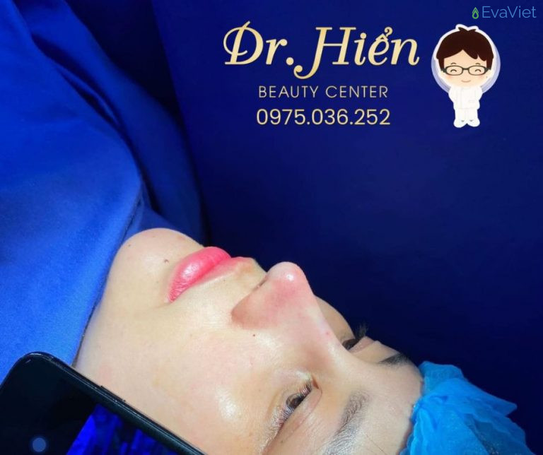 Dr Hiển địa điểm nâng mũi uy tín cho các tín đồ làm đẹp