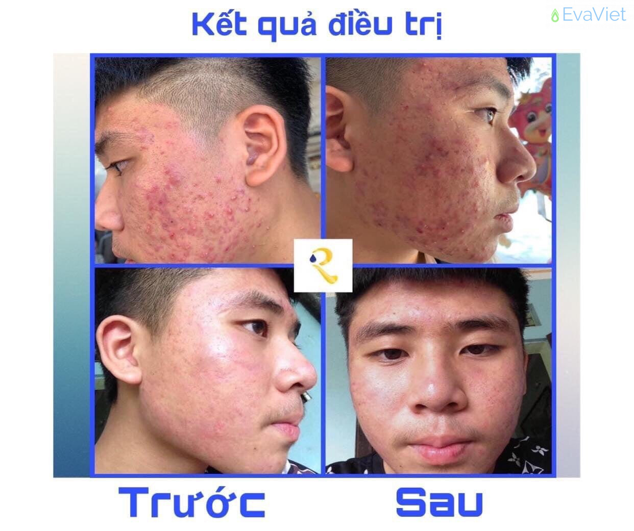 Reney Spa Tây Ninh 6.jpeg